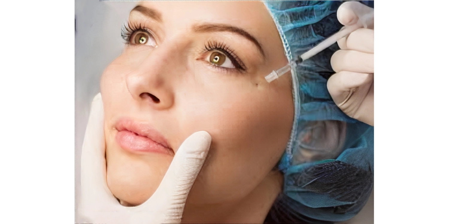 فیلر زیر چشم