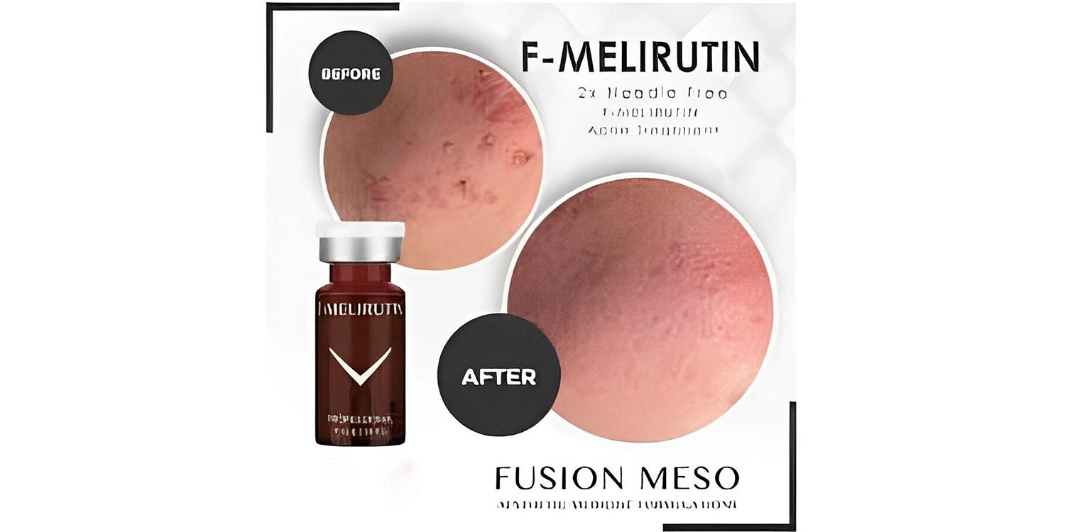 کوکتل ملیروتین فیوژن