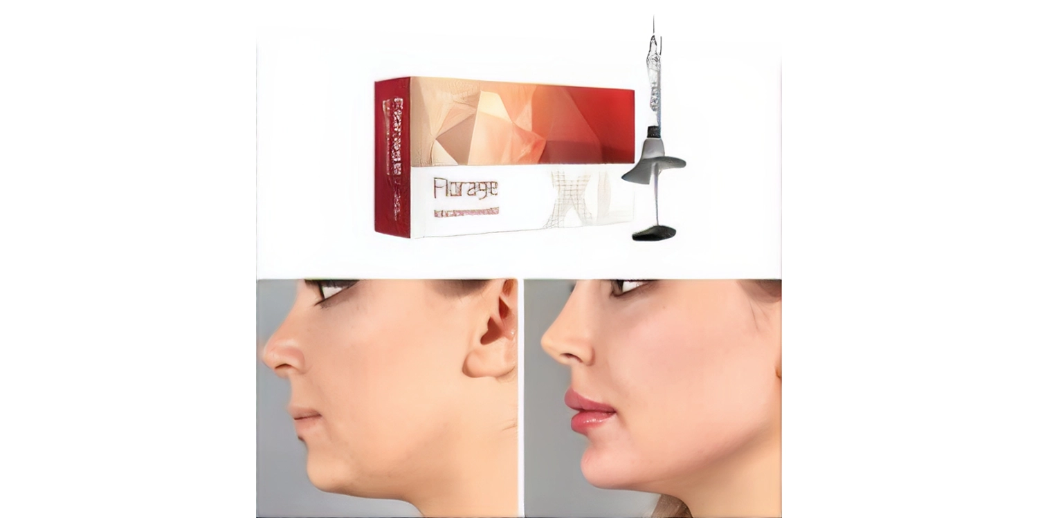 ژل فیورج ایکس ال