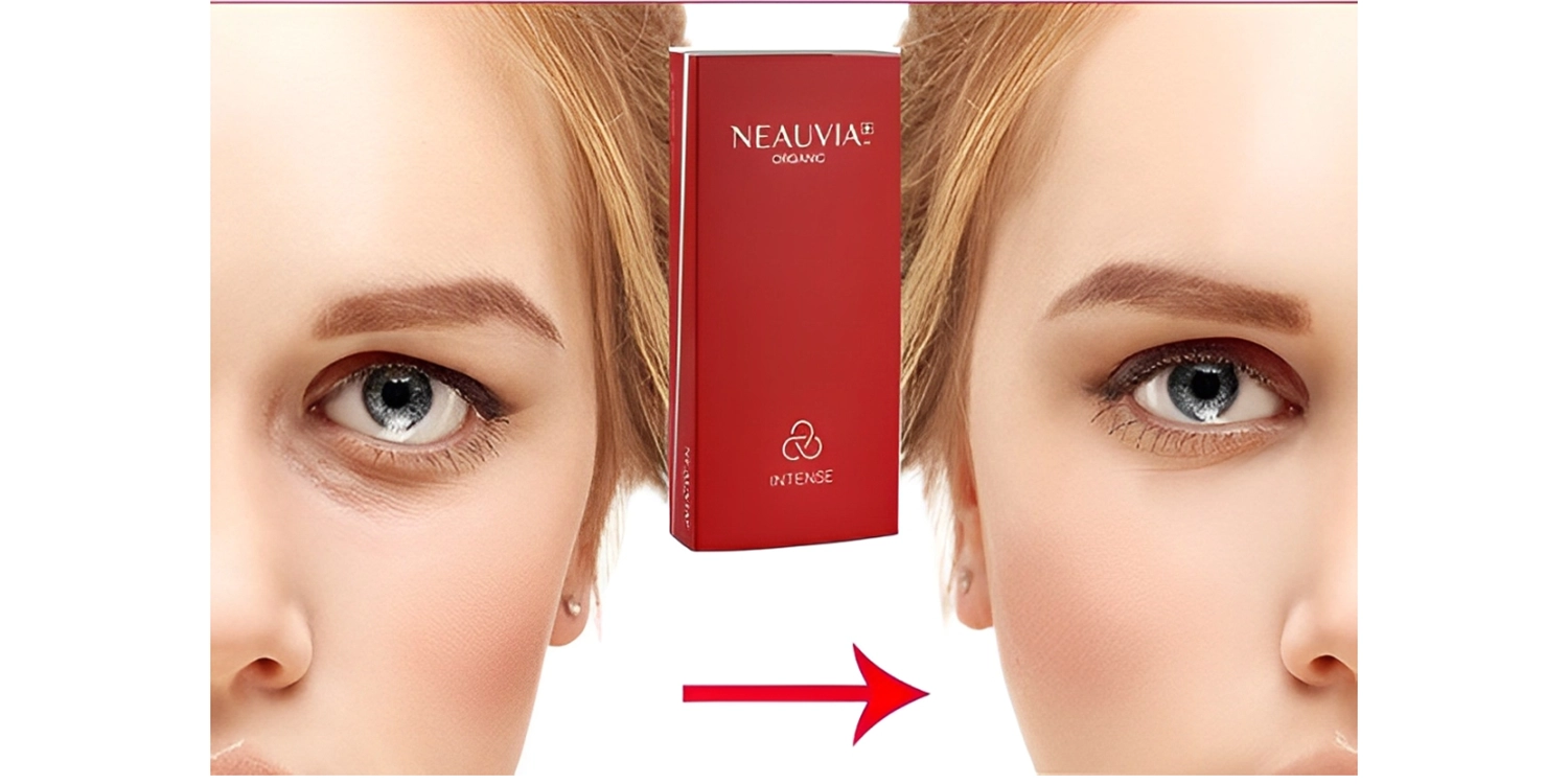 ژل نیوویا اینتنس